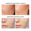 photo skin rejuvenation