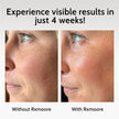 rxmoore mask get results in 4 weeks