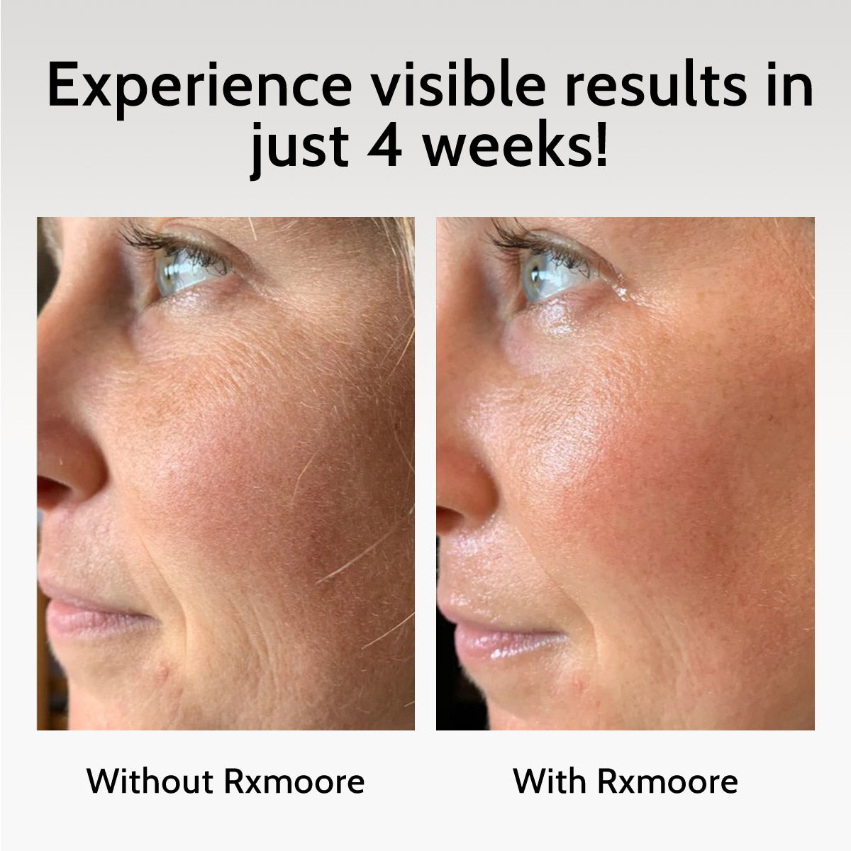 rxmoore mask get results in 4 weeks